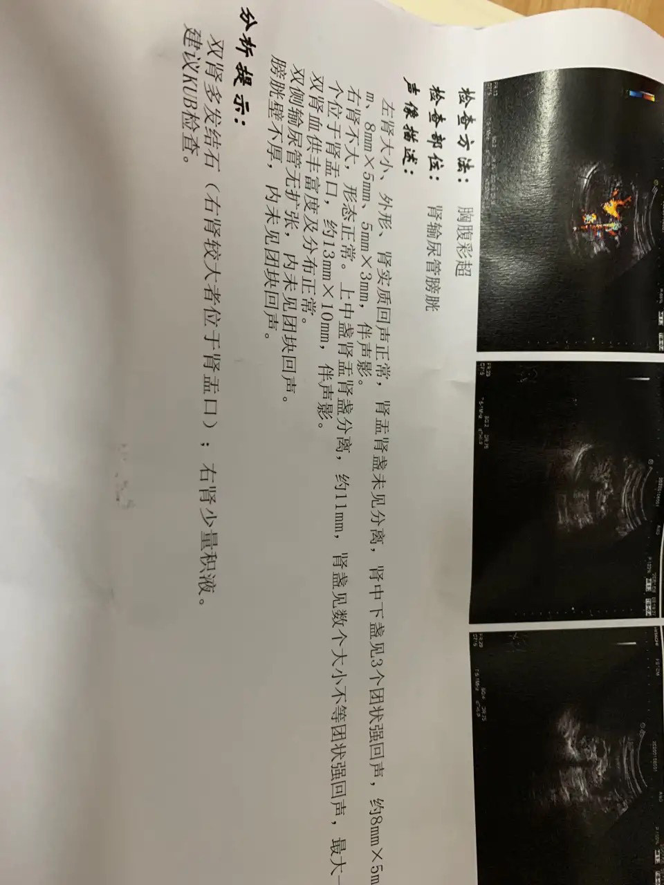 2018年9月右肾做了微创手术,第一张图片是2020年1月份在中医院(做手术