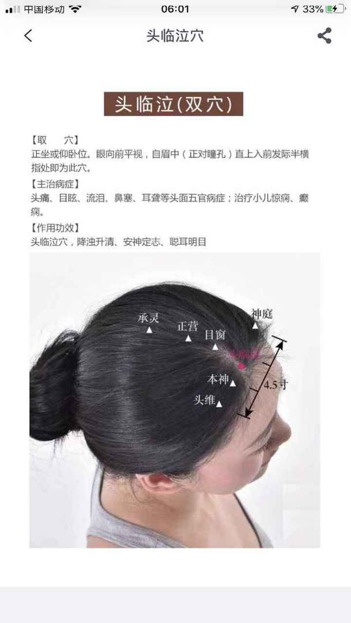 每日一穴 头临泣穴归属足少阳胆经 作用:头痛,目眩,流泪,耳聋,治疗