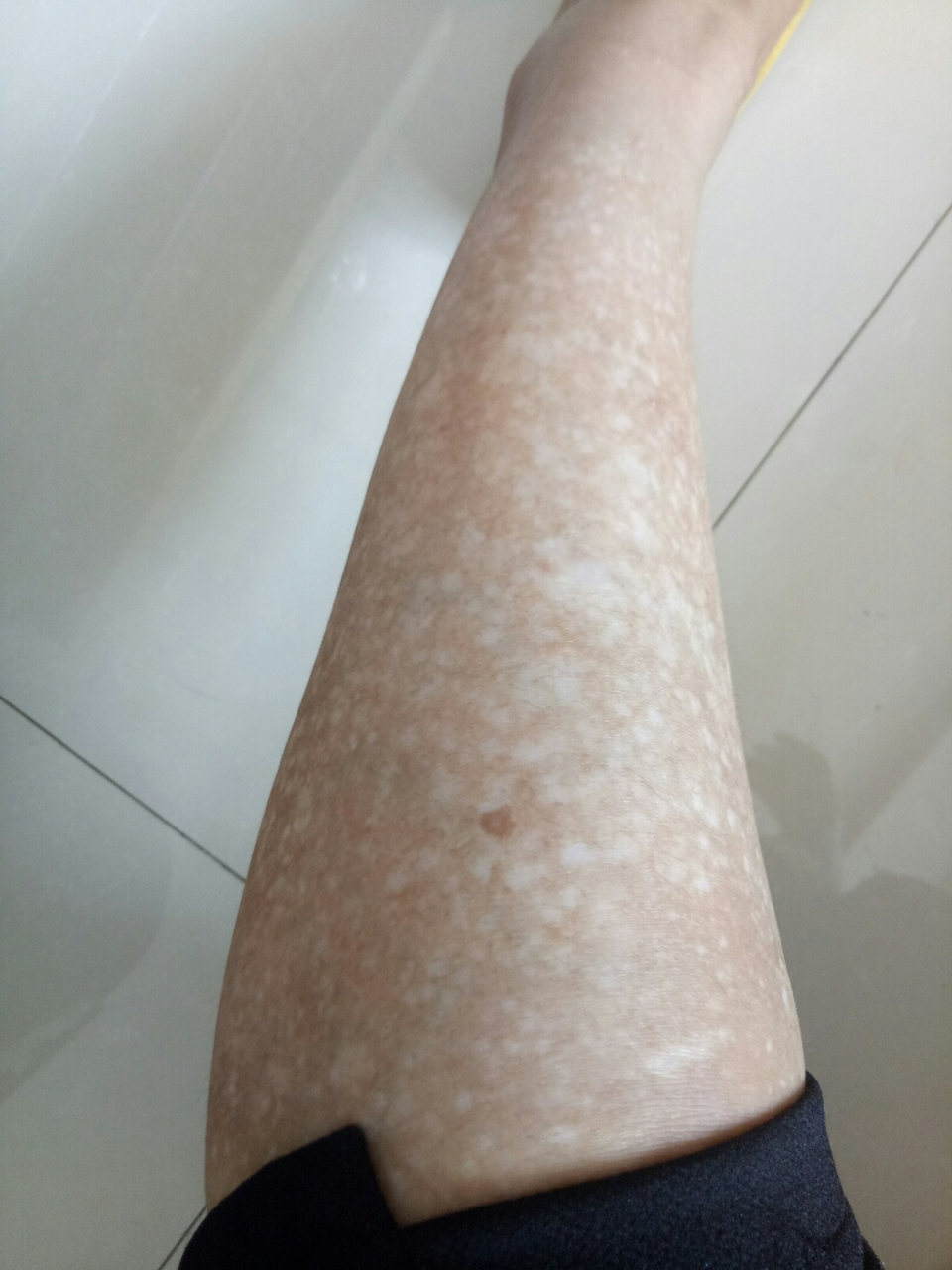 一到夏天,别人都短袖裙子的穿着,只有我长袖长裤的穿着,像个怪物一样