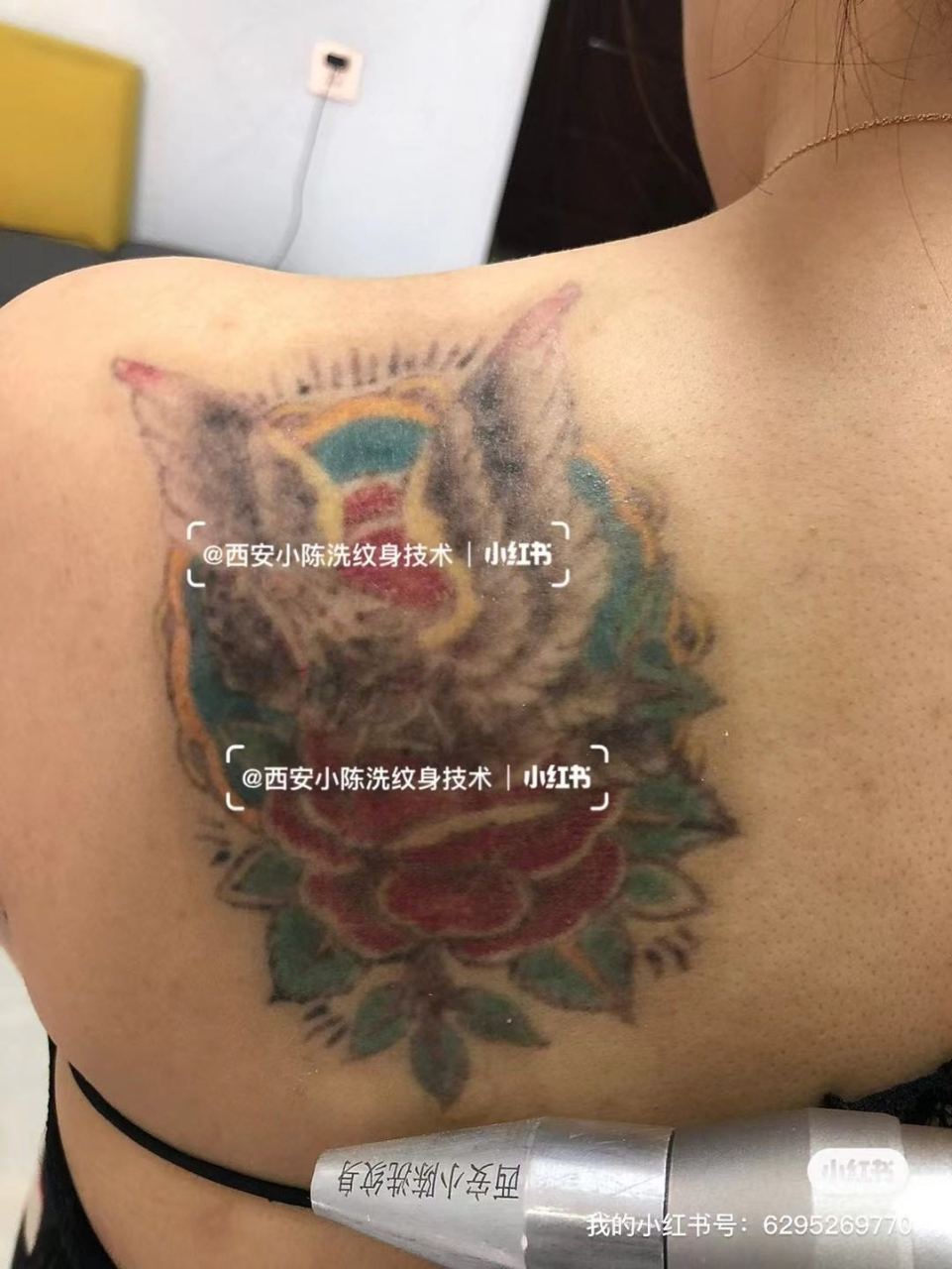 彩色二手纹身清洗四次记录,继续处理,持续更新