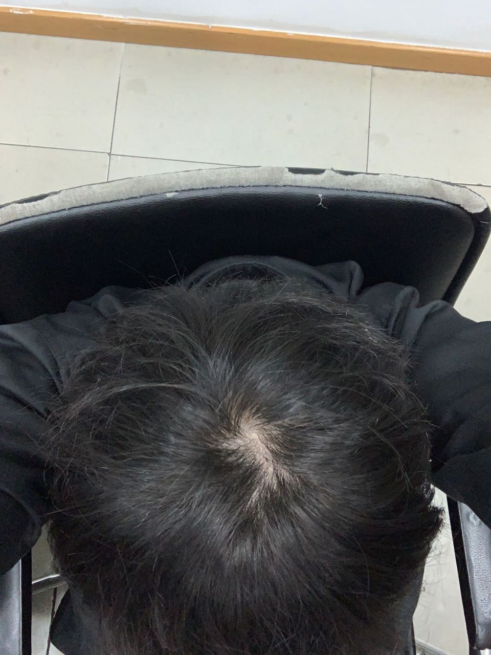 头旋这样算正常吗?大佬们