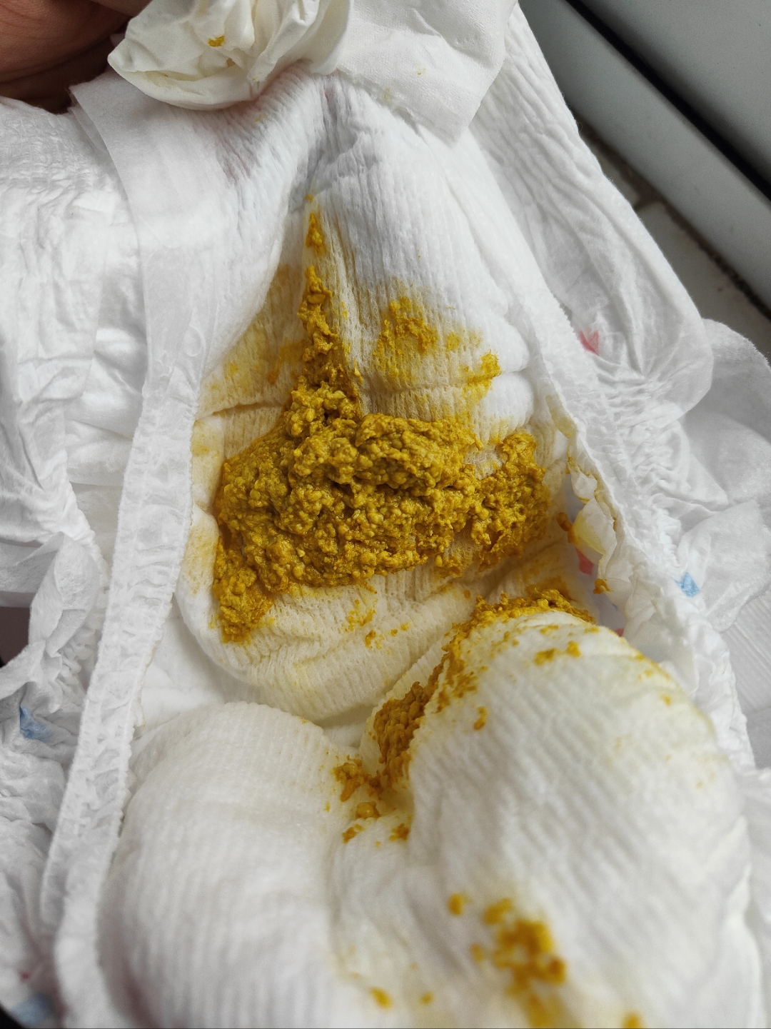 宝宝出生二十天了,一天大便五六次正常吗