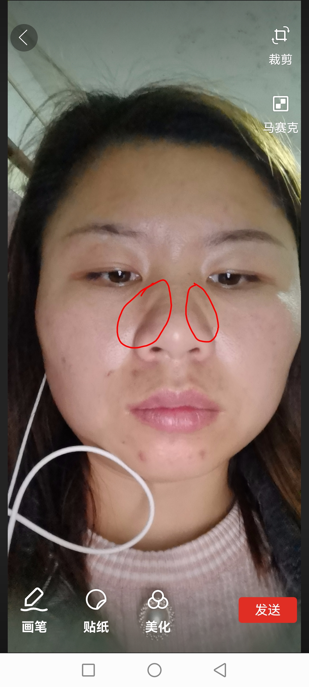 不知从啥时候起鼻子两旁就有这两道痕了,怎么搞都