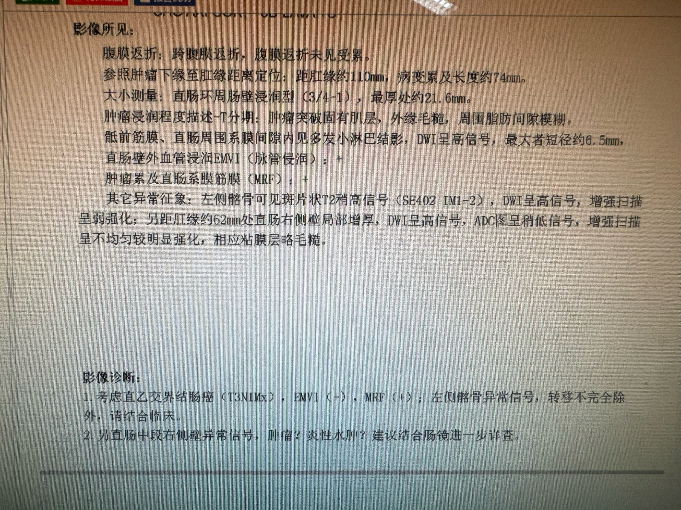 临床案例 今日肠癌病例 68岁男性患者