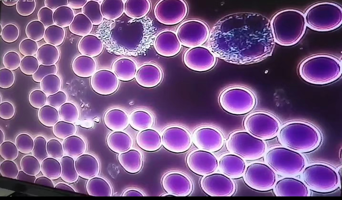 人体重要免疫细胞-nk细胞  nk细胞称为自然杀伤细胞,来源于骨髓淋巴样