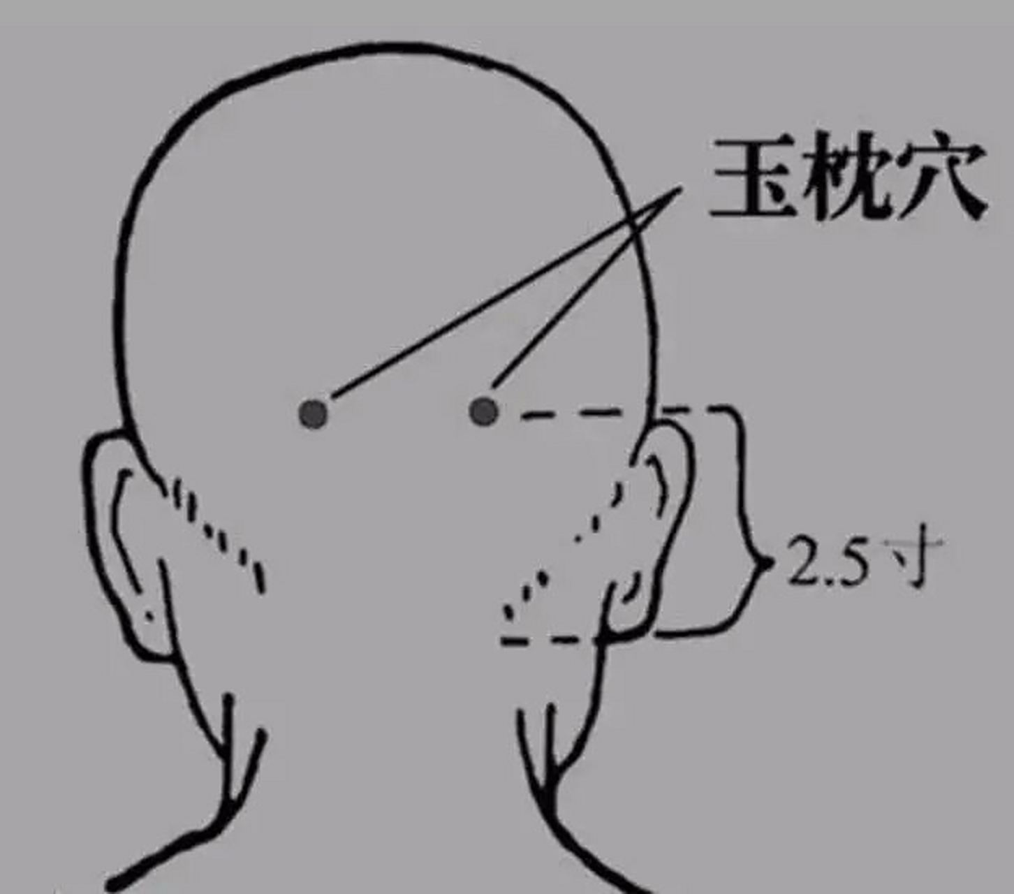 敲击玉枕穴,每边15次以上.