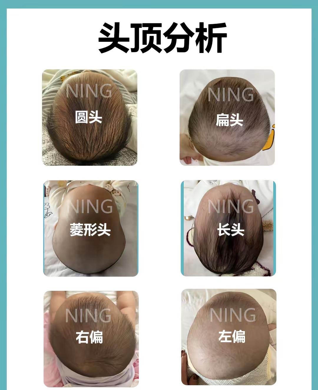 0-3个月宝宝睡姿图解婴儿不正常头型图小宝宝额头窄图片0-3个月婴 