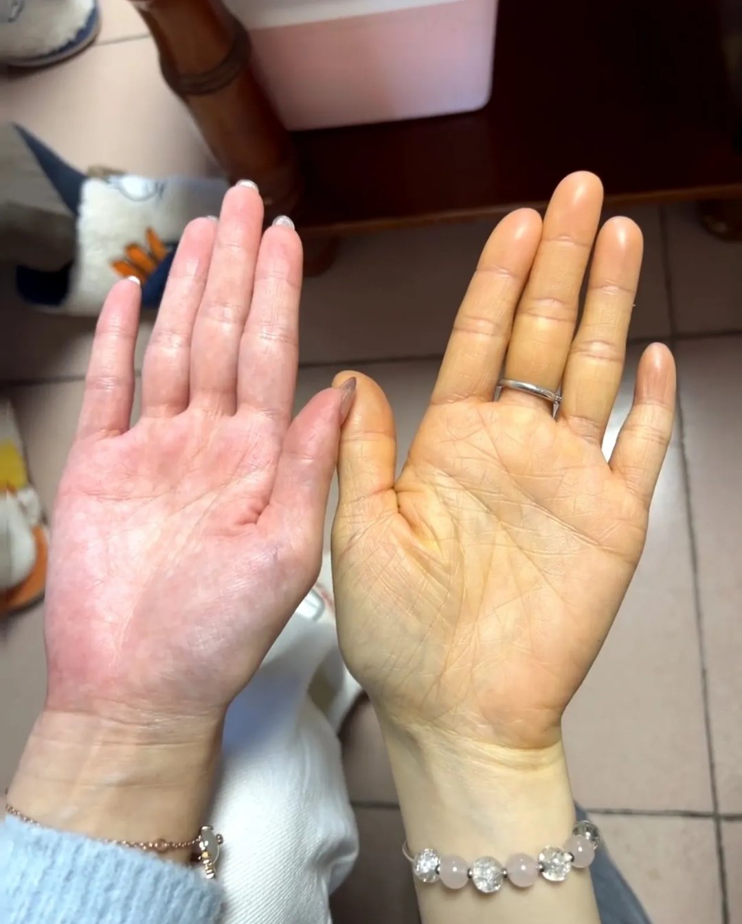 我这么大的人都没见过这么黄的手,她全身其他地方都挺白的,只有手黄得