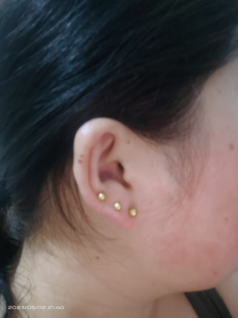 那个大师帮忙看看,耳朵大痣什么意思,脖子还一个