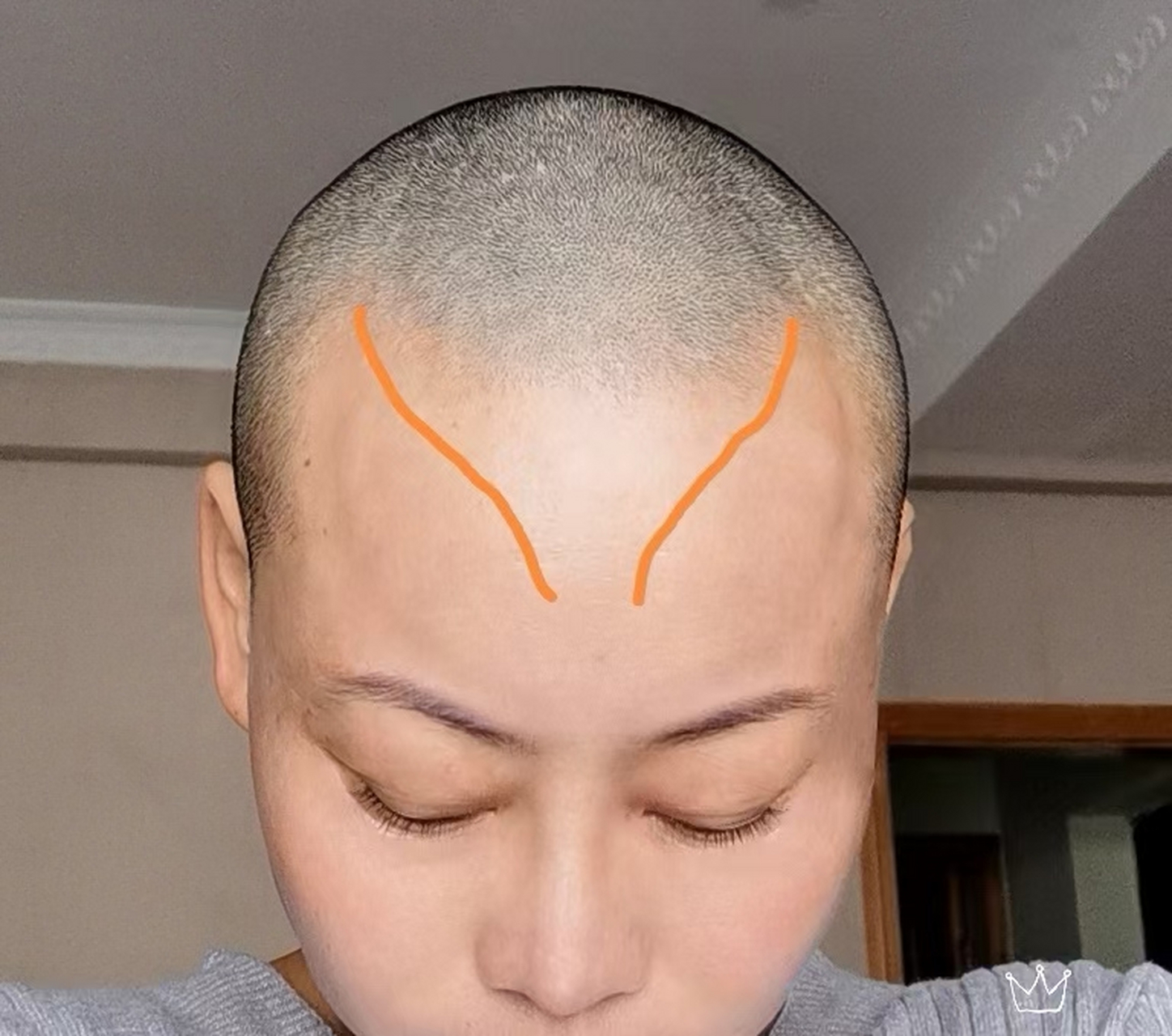 女八龙角骨