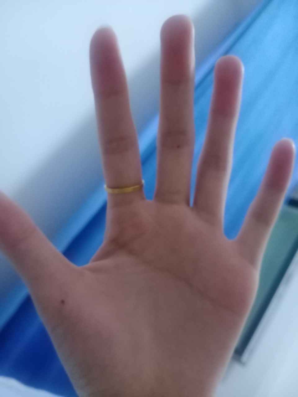 左手中指和大拇指的痣是最近突然有的 是有什么寓意吗?