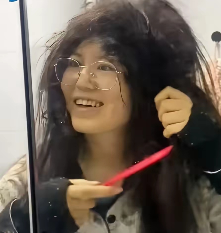 河北一女子坐月子60天没洗头,喜获永久"高颅顶",一个头两个大!