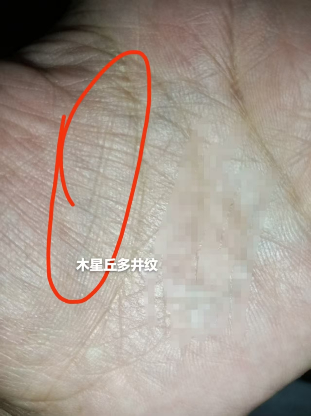难怪妈妈对我照顾有加