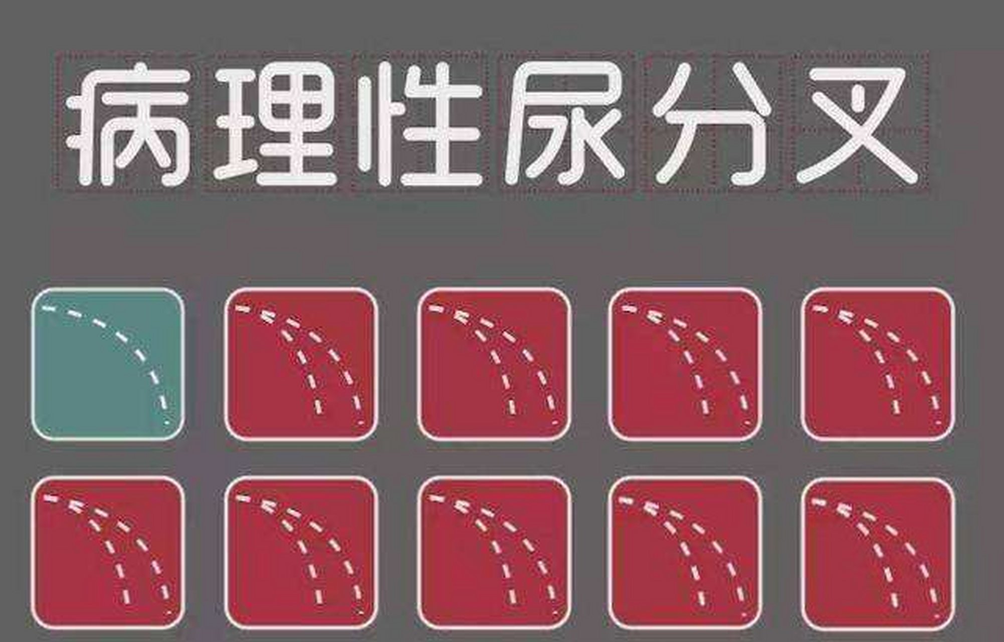 生理原因:性生活过频,手淫过度,生殖器充血损伤都可以导致尿分叉.