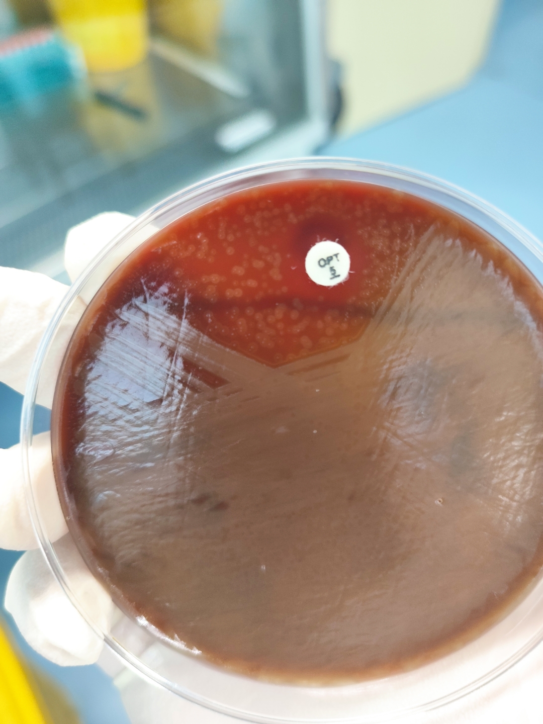 铁锈色痰.肺链.