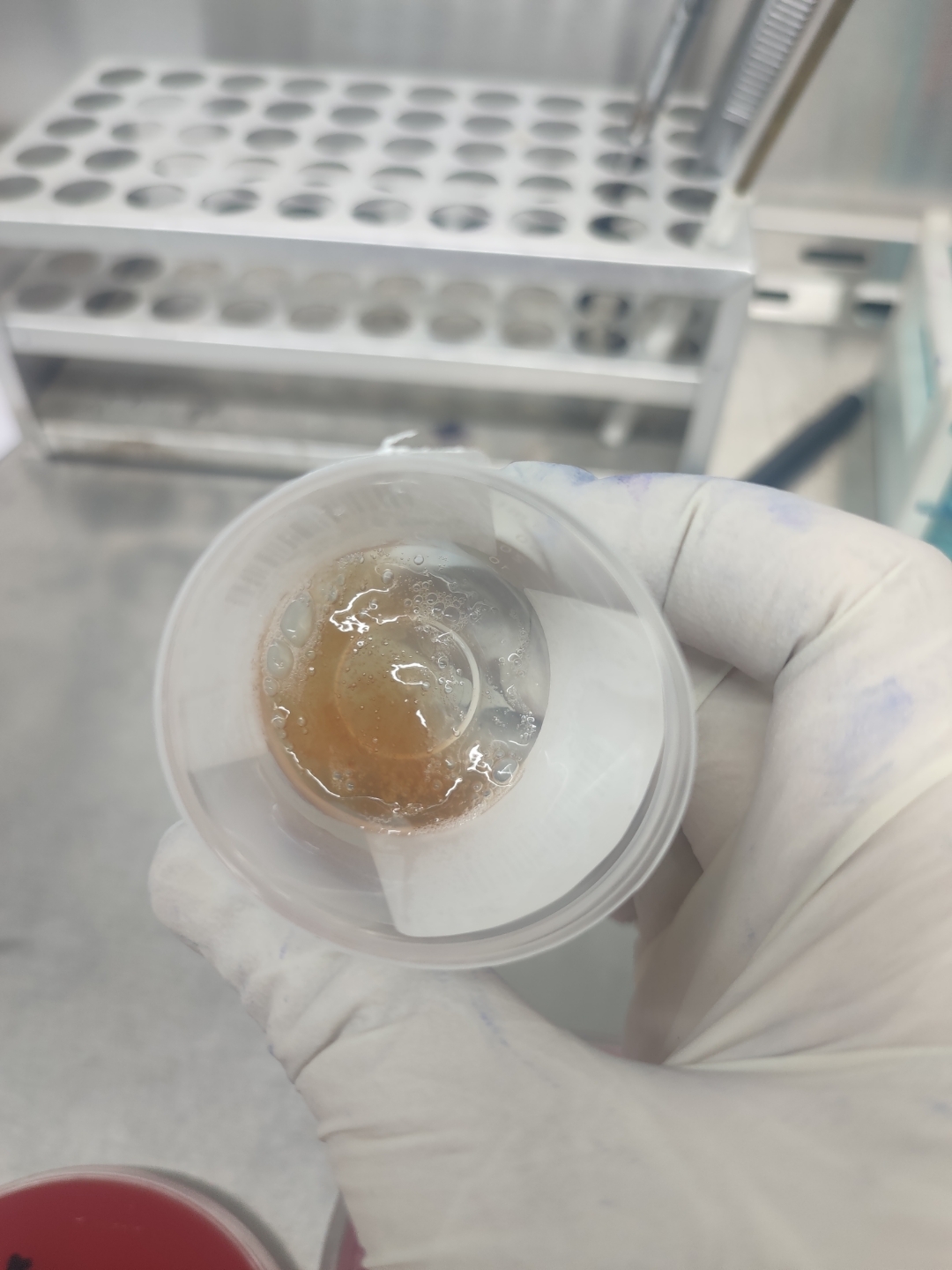 铁锈色痰.肺链.