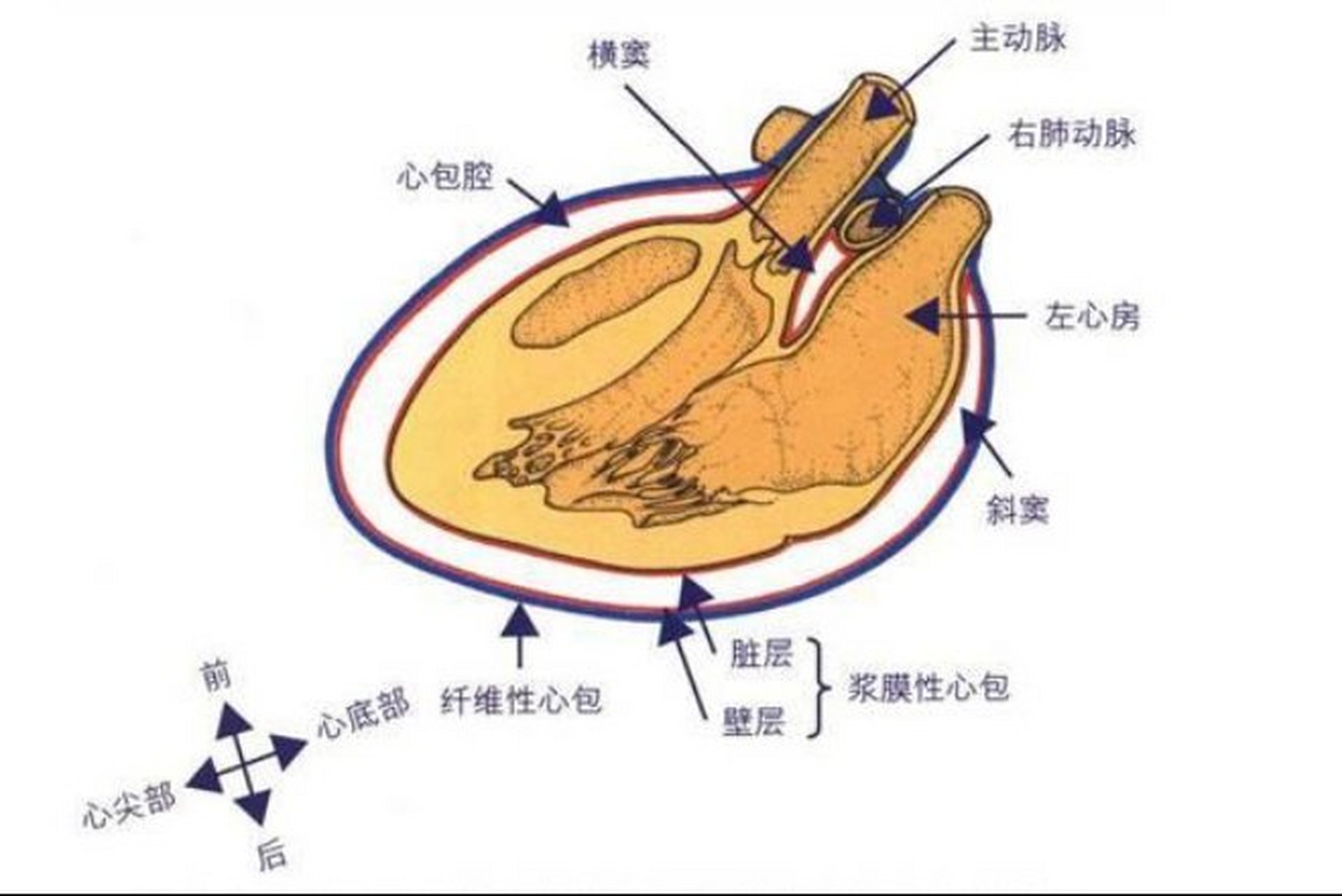 纤维心包图片