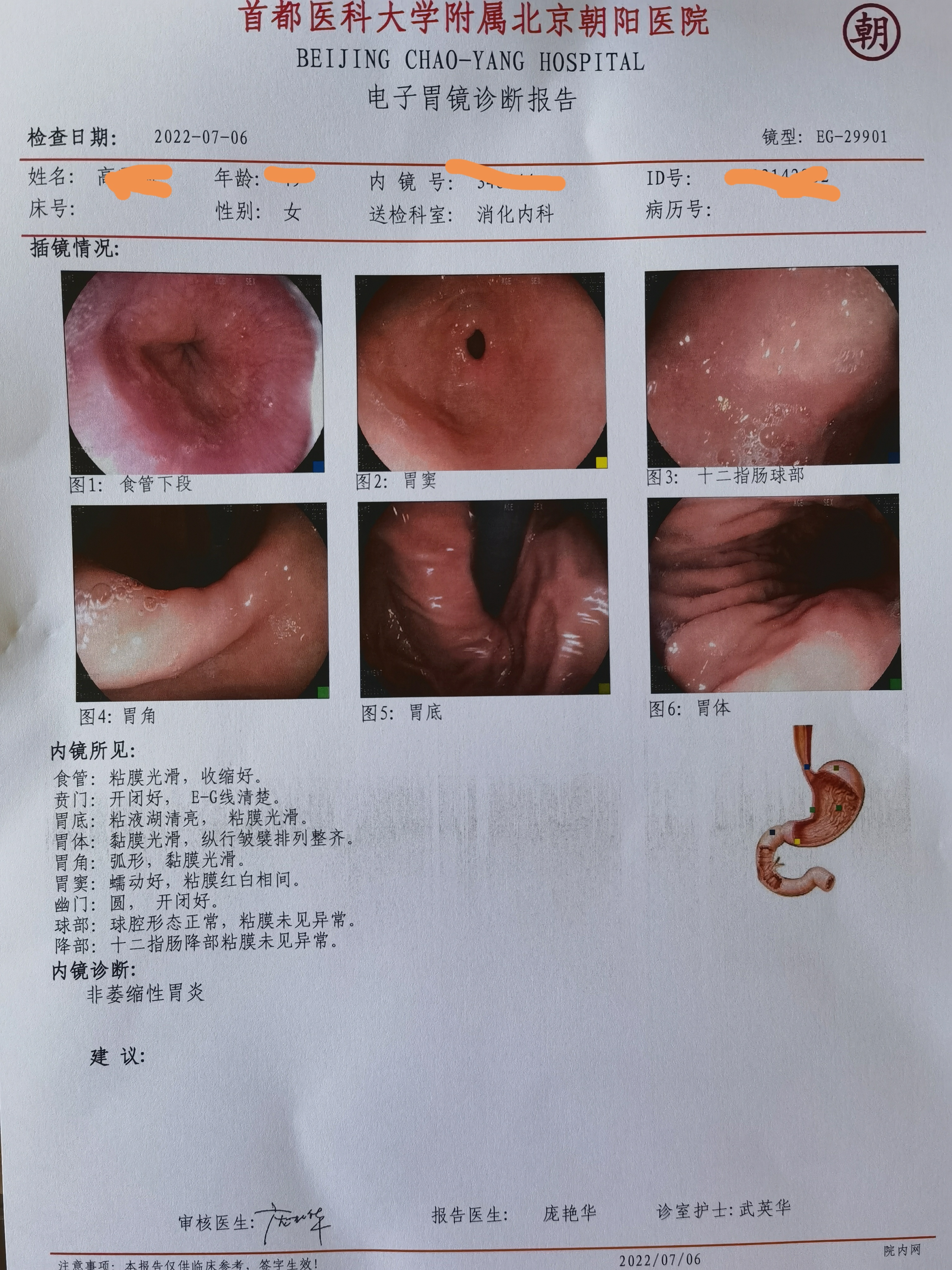 胃病单子真实图片2020图片