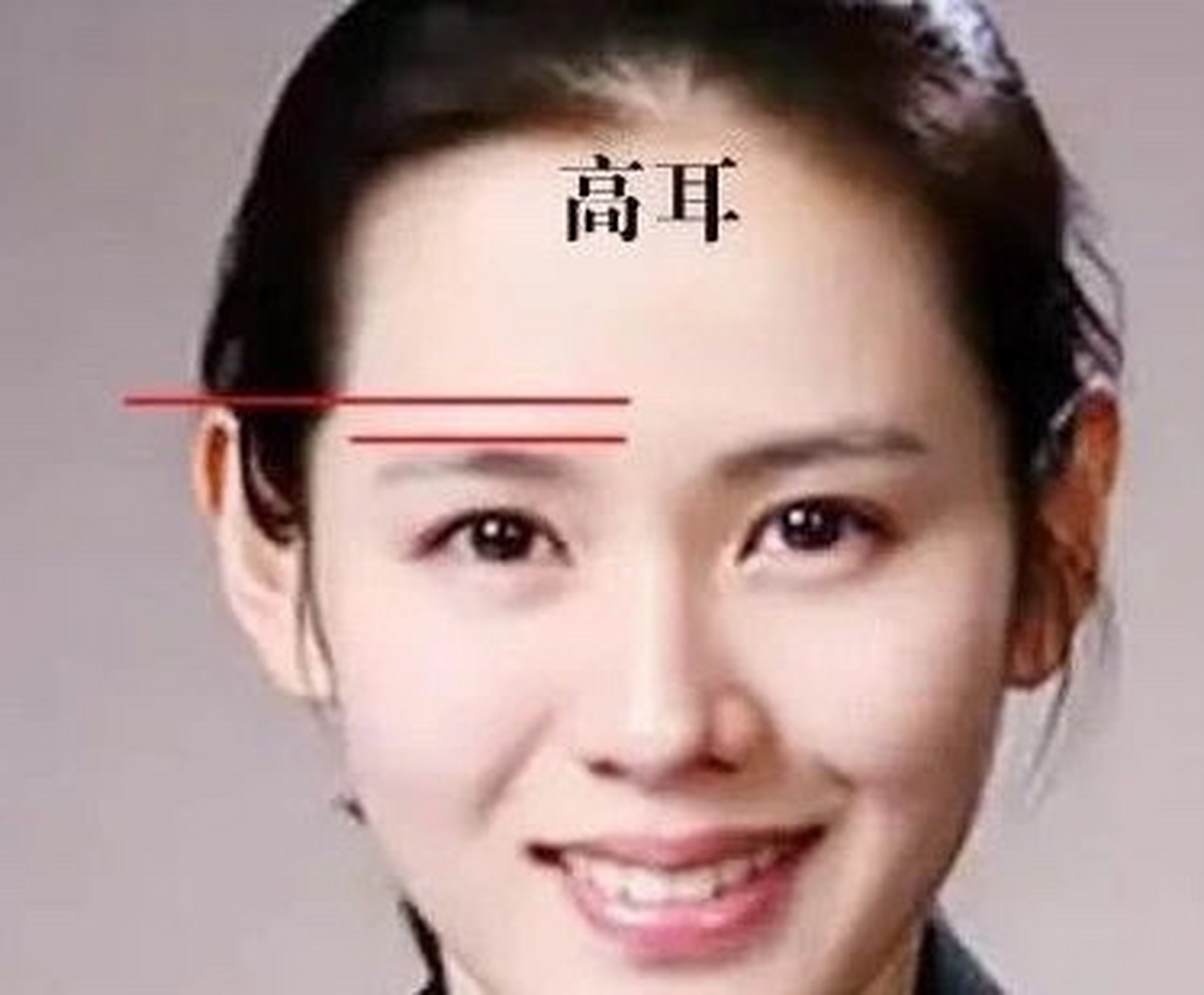 这里指的是,耳朵厚实有肉,加上耳朵达到眉尾的上端,这类耳相的人,往往