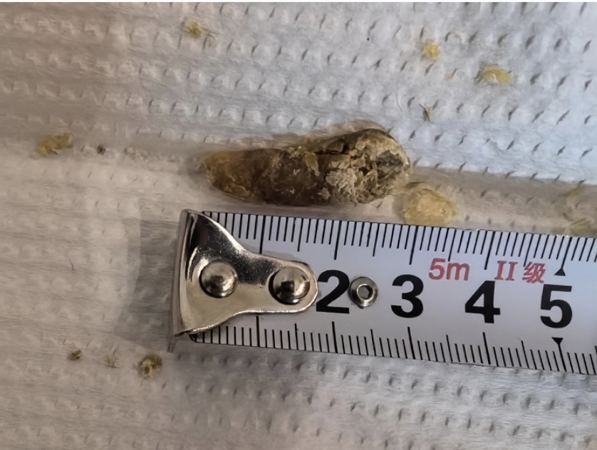 谁能想到这竟然是从鼻孔里掏出来的东西呢?真的是好大一块呀!