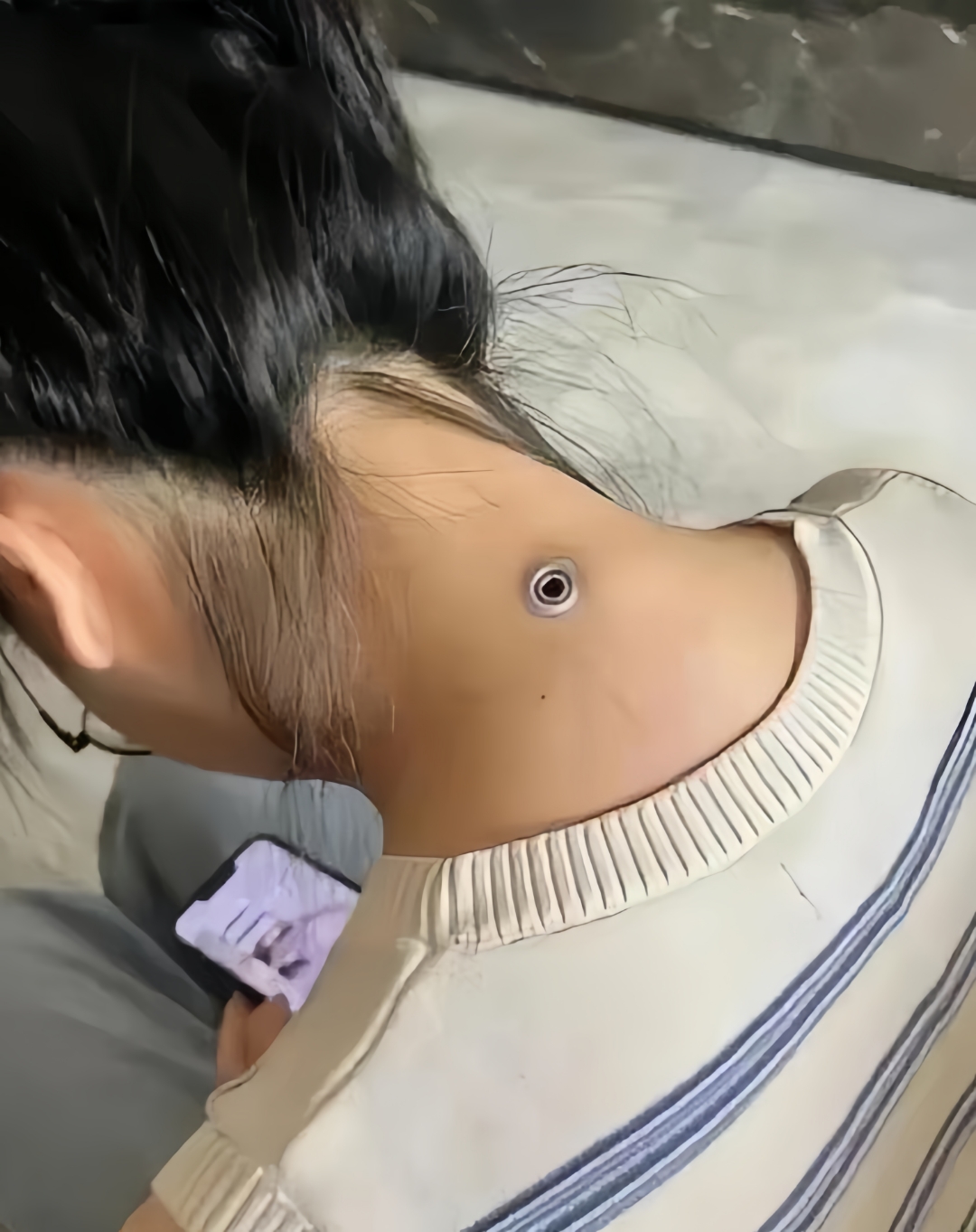 我这好奇心都要爆棚啦,就等后背皮肤上有个小洞很深后背上有个小洞眼