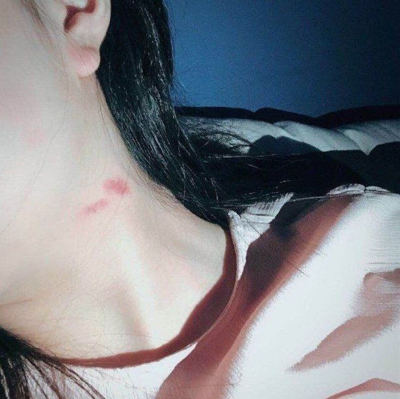 女生脖子疼被吸血图片