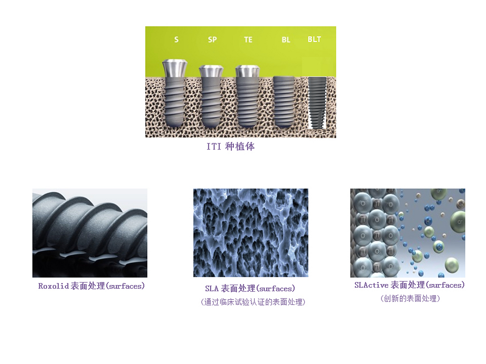 士卓曼(straumann)种植体 产品介绍:iti种植体是瑞士strauamann公司