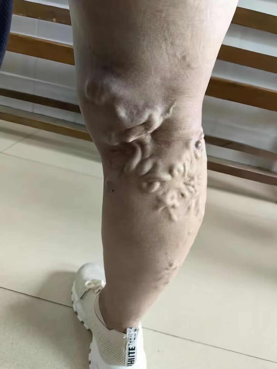求助!广东的朋友发来图片,我一看吓了一大跳,这是什么情况?