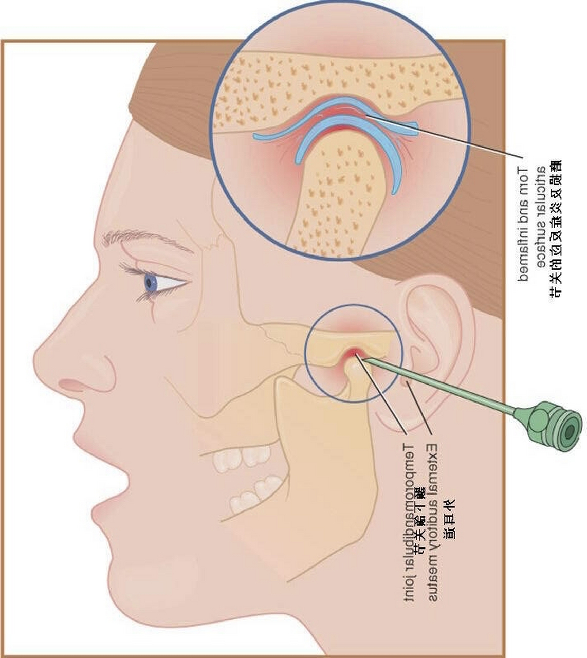 颞下颌关节位置图图片