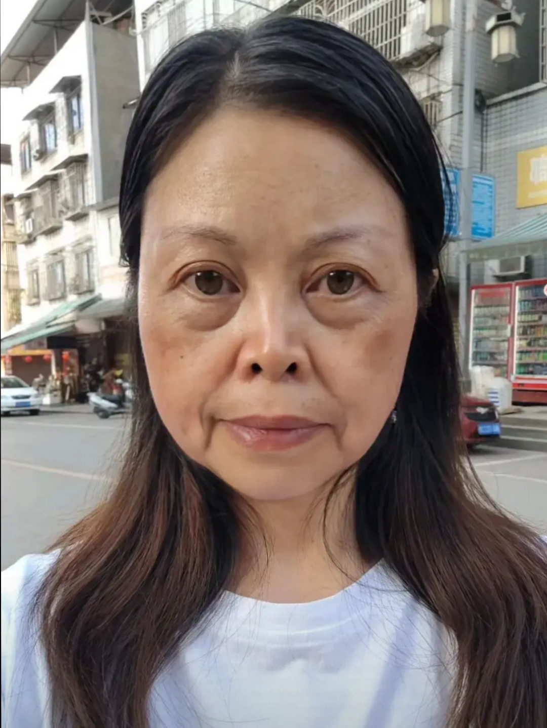 43岁82年生中年妇女用亲身经历告诫别生气 她婚后无数次生气气出胃病