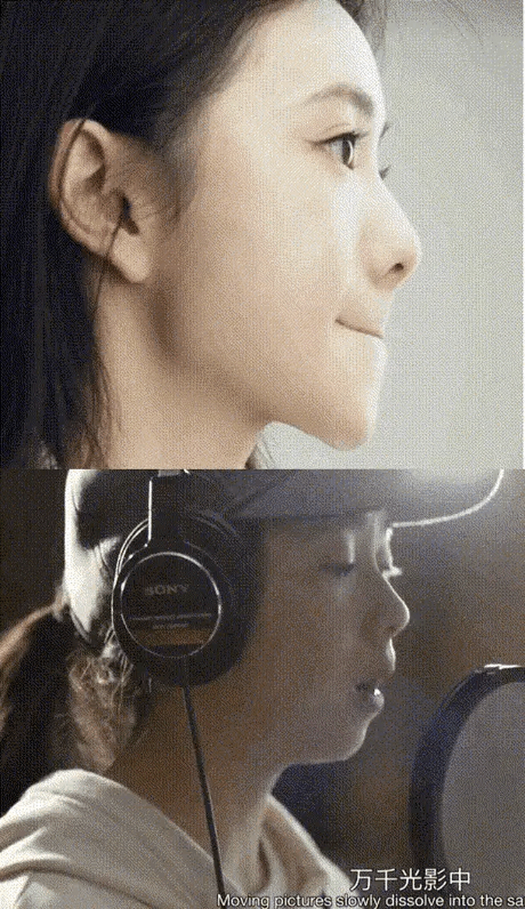 刘浩存整下巴整的很成功唉,短宽脸没下巴就很土气,变成正常下巴后整个