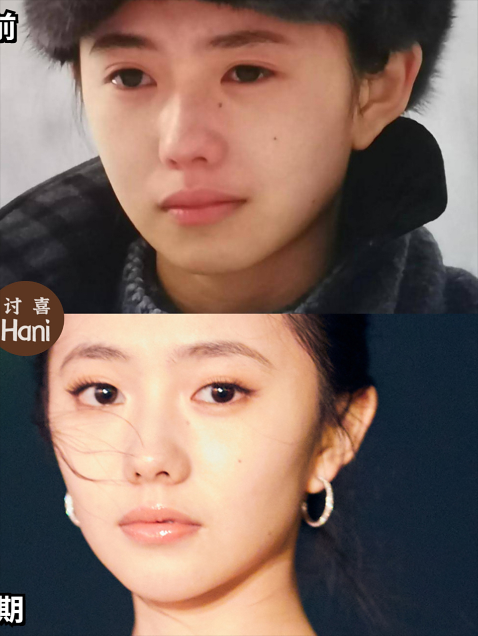 刘浩存整下巴整的很成功唉,短宽脸没下巴就很土气,变成正常下巴后整个