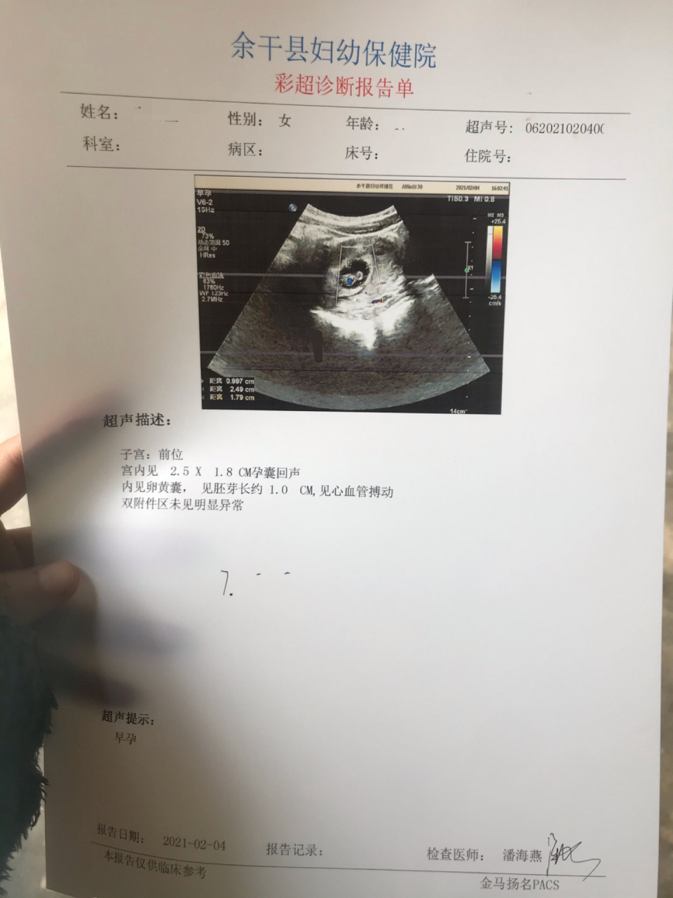 怀孕五十多天 是男孩还是女孩
