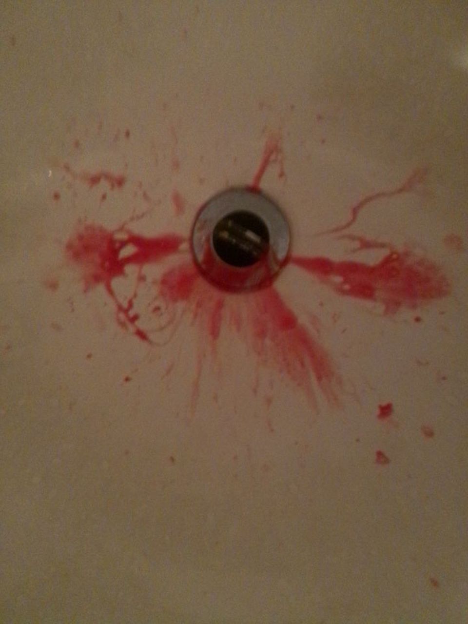 急火攻心,我又吐血了,亲生爸爸是癌症去世的,我真的好害怕[流泪]  不