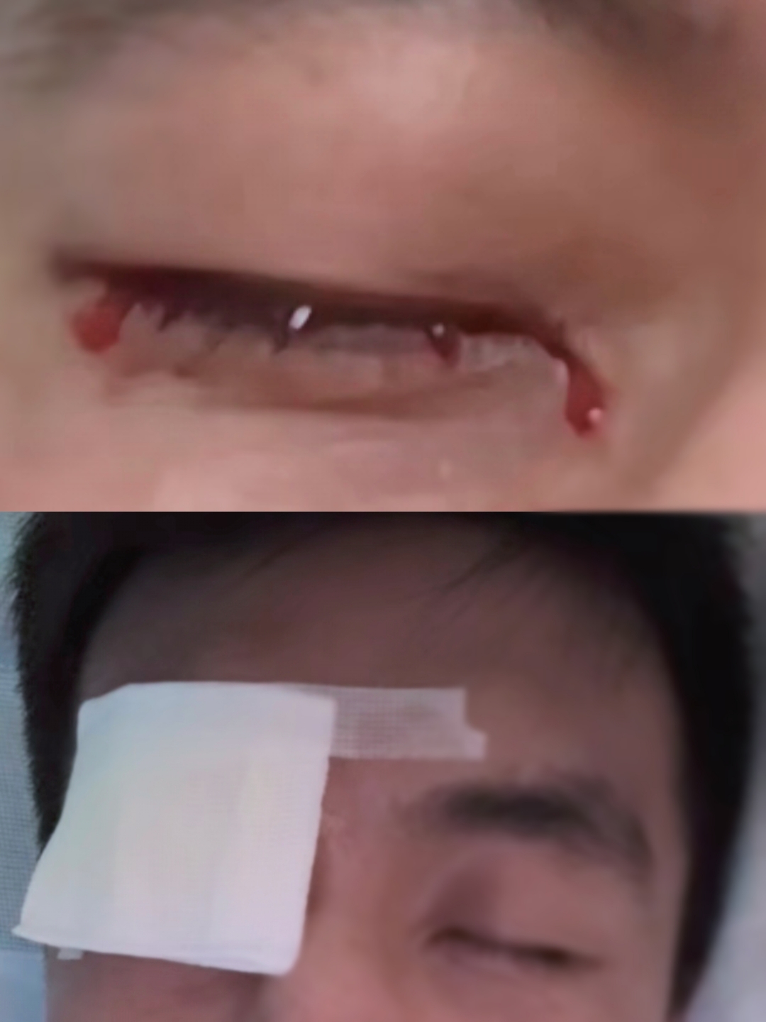 男主受伤伤口疼的视频