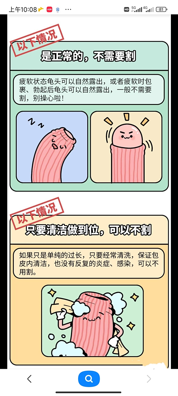 沈阳男科医院科普  包皮垢引起的龟头炎,是一种非细菌性感染,是包皮