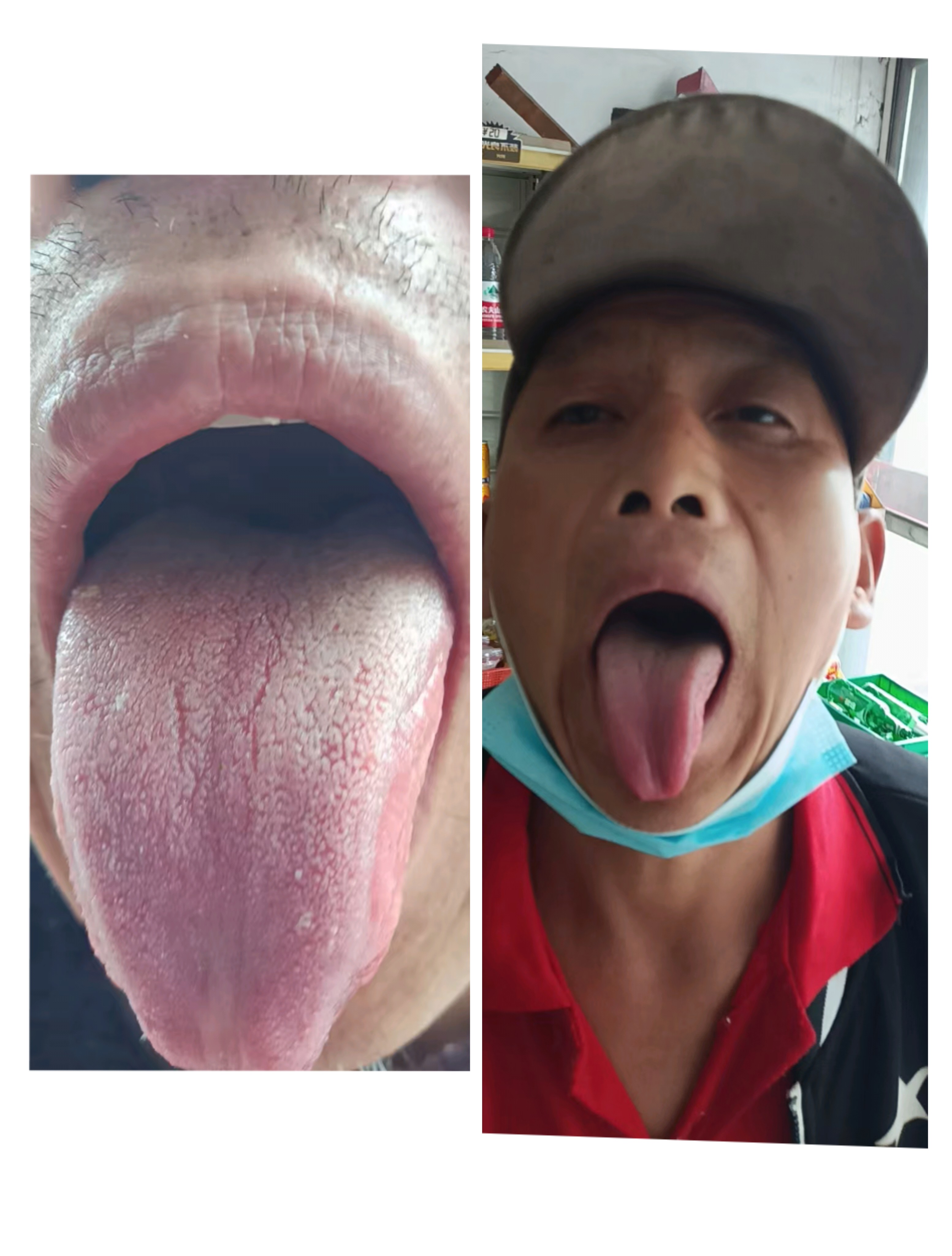 包含安貞醫(yī)院黃牛預(yù)約掛號(hào)解惑黃牛掛號(hào)的詞條