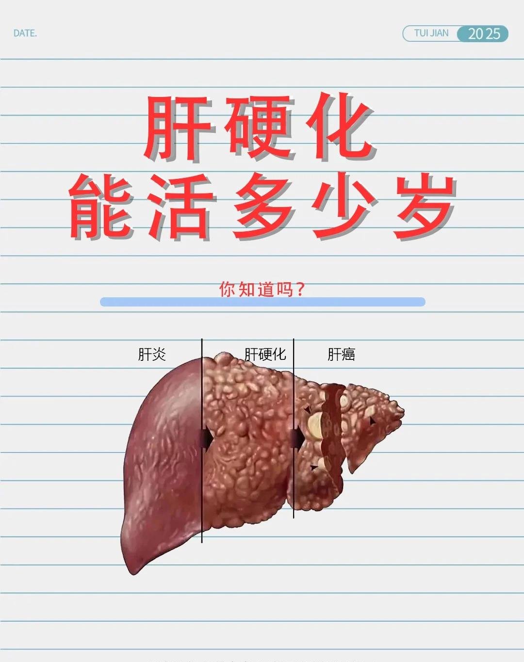 为什么会引起肝硬化
