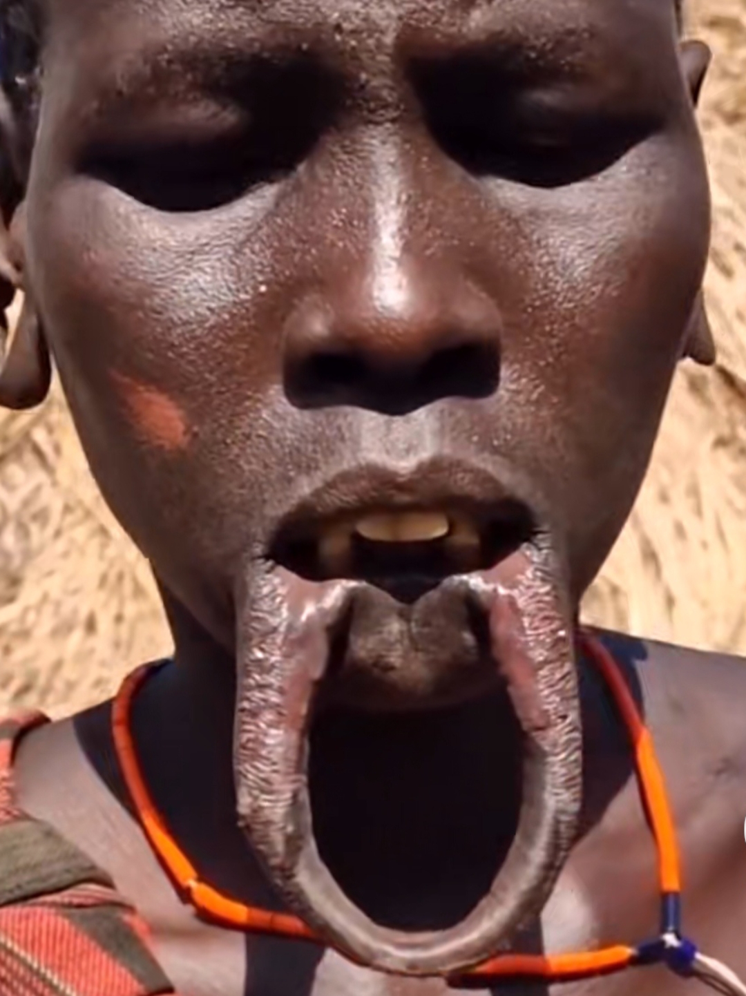 一位非洲奇人出现了,黑黑的面脸, 嘴的下唇脱离长出一个大个圆形肉环