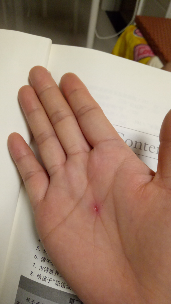 女儿看到我右手心有个小伤口,她说妈妈这个多久才能好?