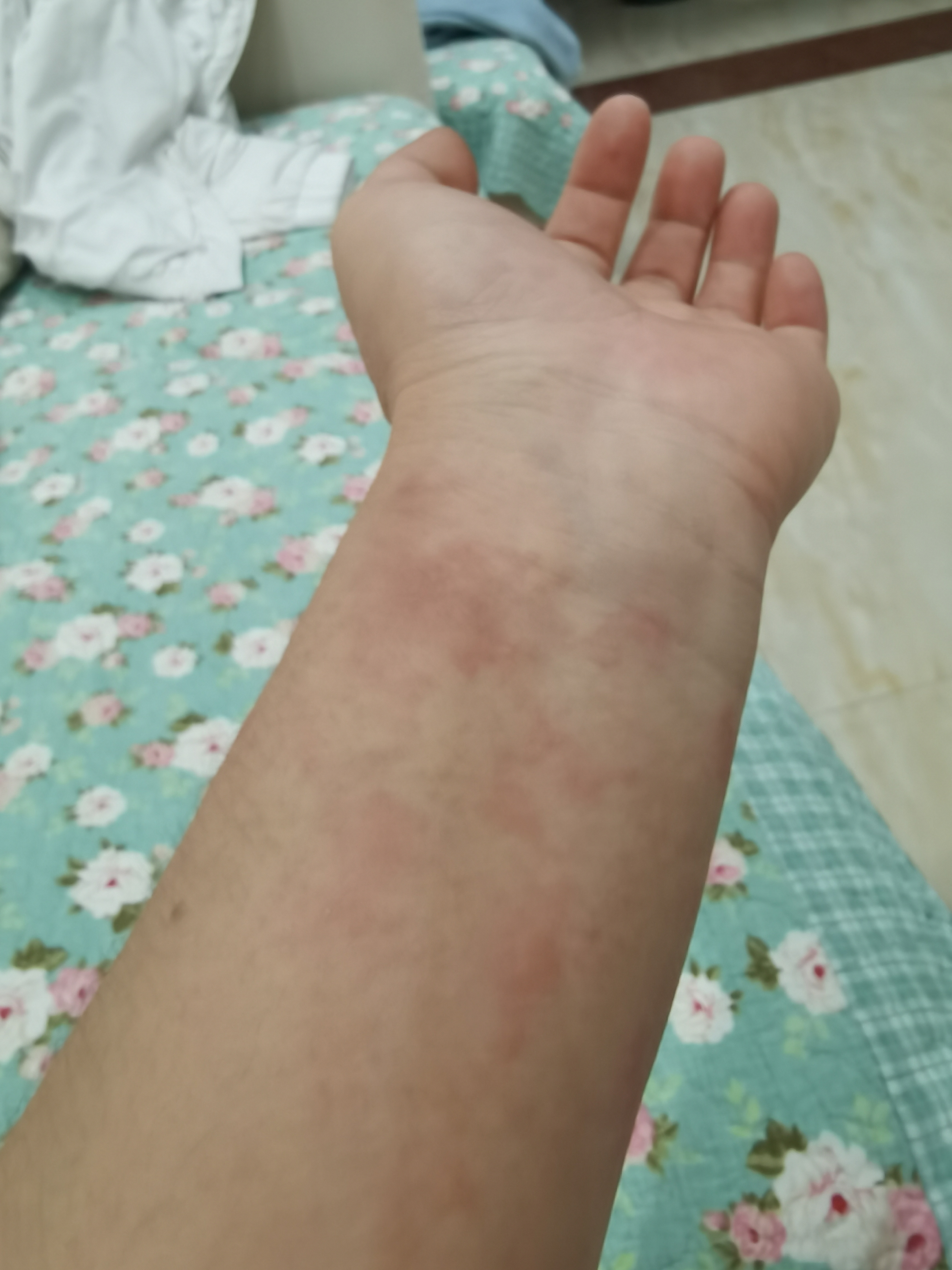 13/今天差了45没有完成小目标,继续加油,就是手上胳膊上过敏,有点痒