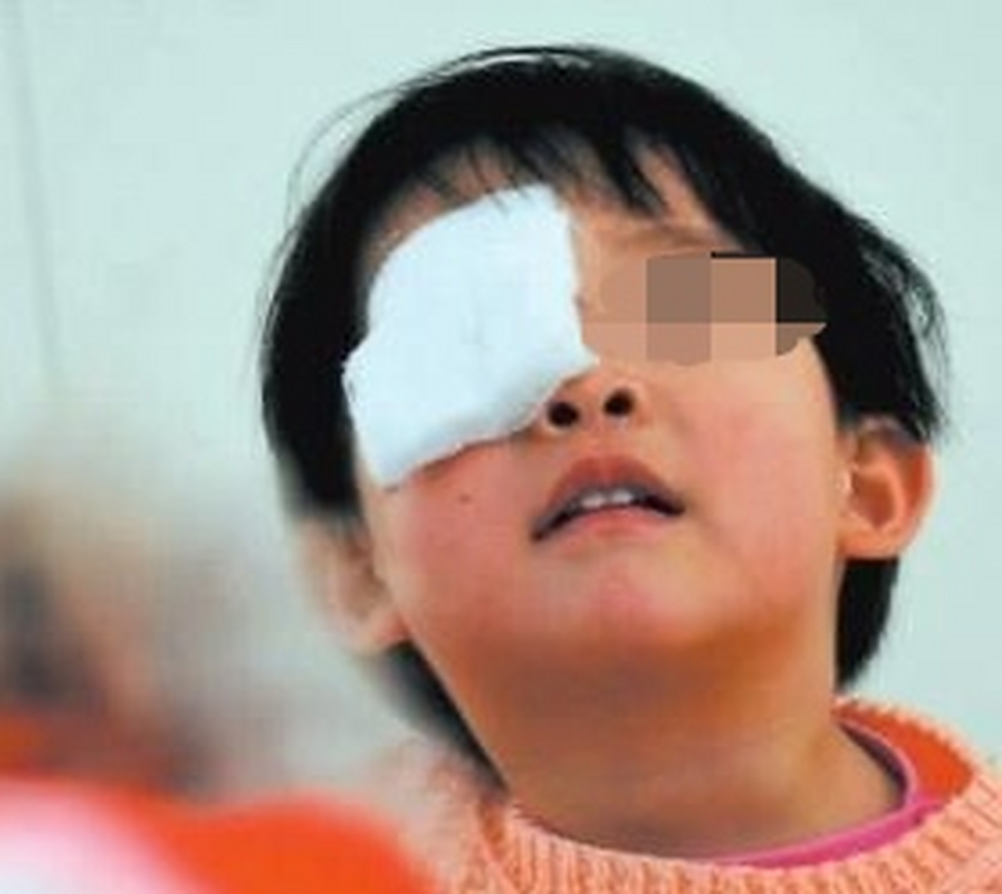 奶奶带孩子,眼睛瞎了一只!  是怎么瞎的呢?
