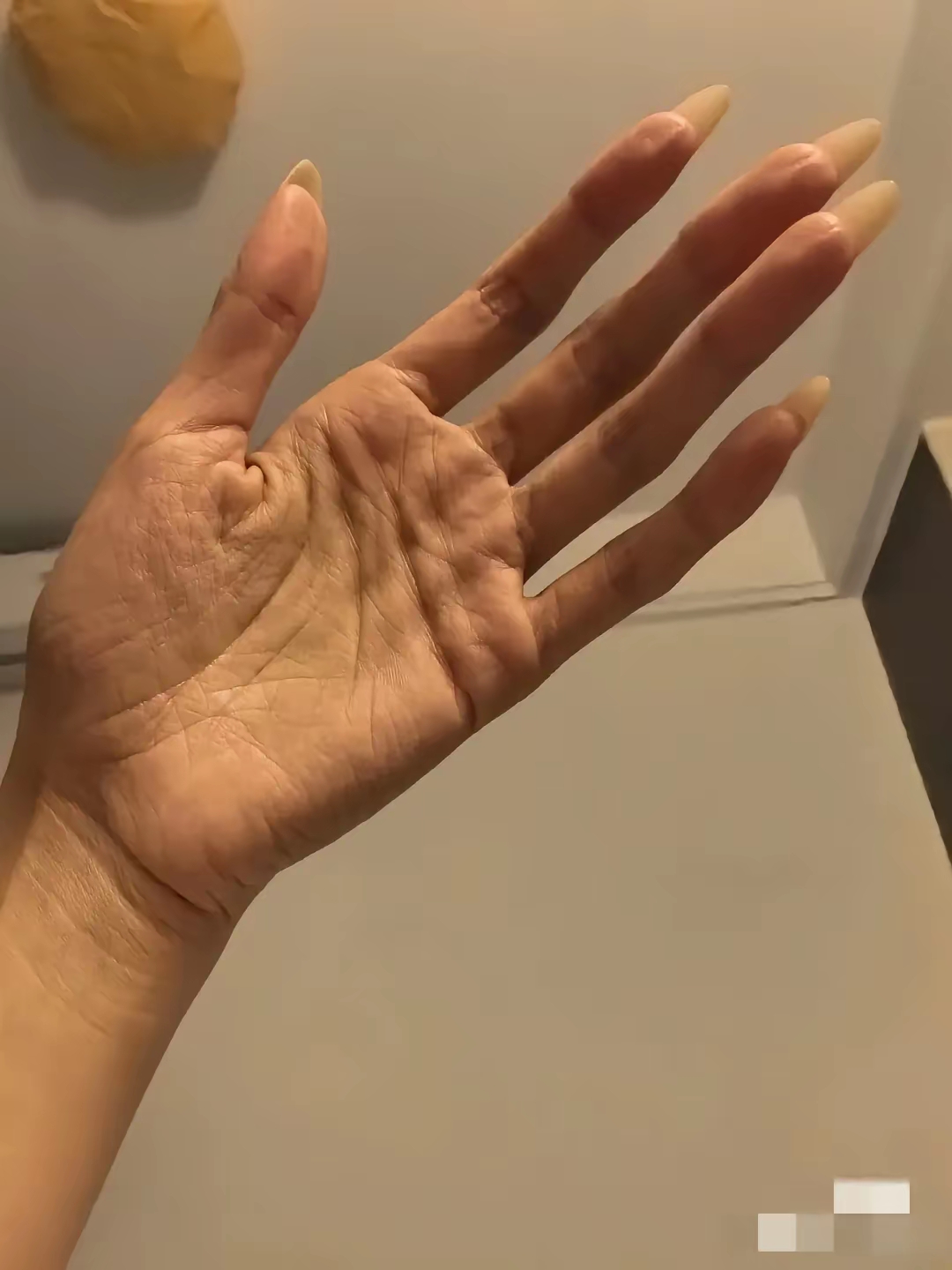 还是缺乏营养的手?还是劳累过度手?还是长期抑郁症的征兆?