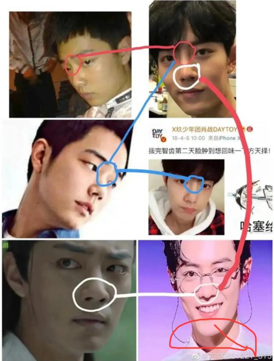 都说整容过度会影响演技,如果本身就没演技更会凸现