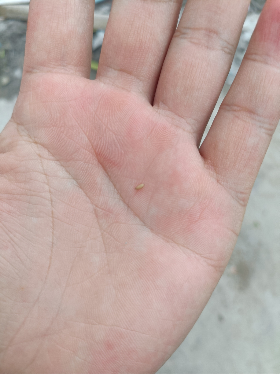 宿舍床板底下出现大量虫卵,请问这是什么东西,怎么清理