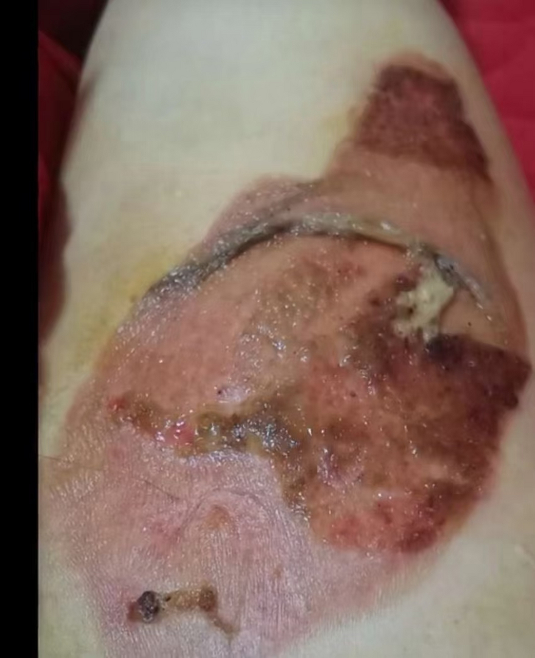 每每看到腿上这块疤,就让我想起你对我的恶劣种种,一字形容"狠"这个