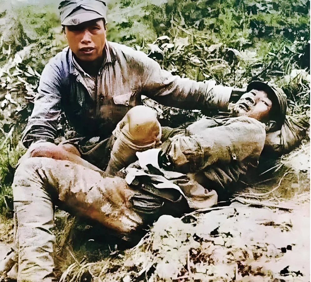 1943 年,中国远征军战士受伤掉队,伤口触目惊心,战友束手无策