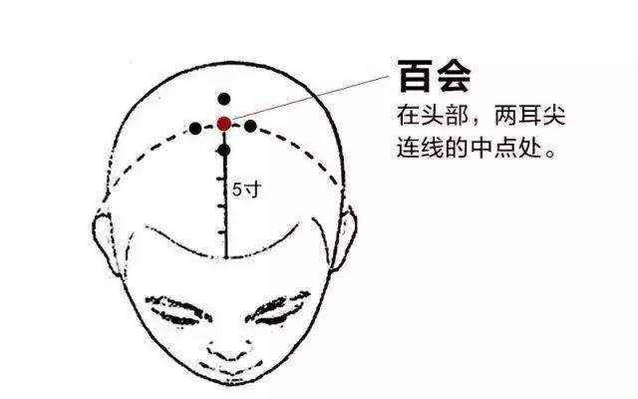 百会位置图片