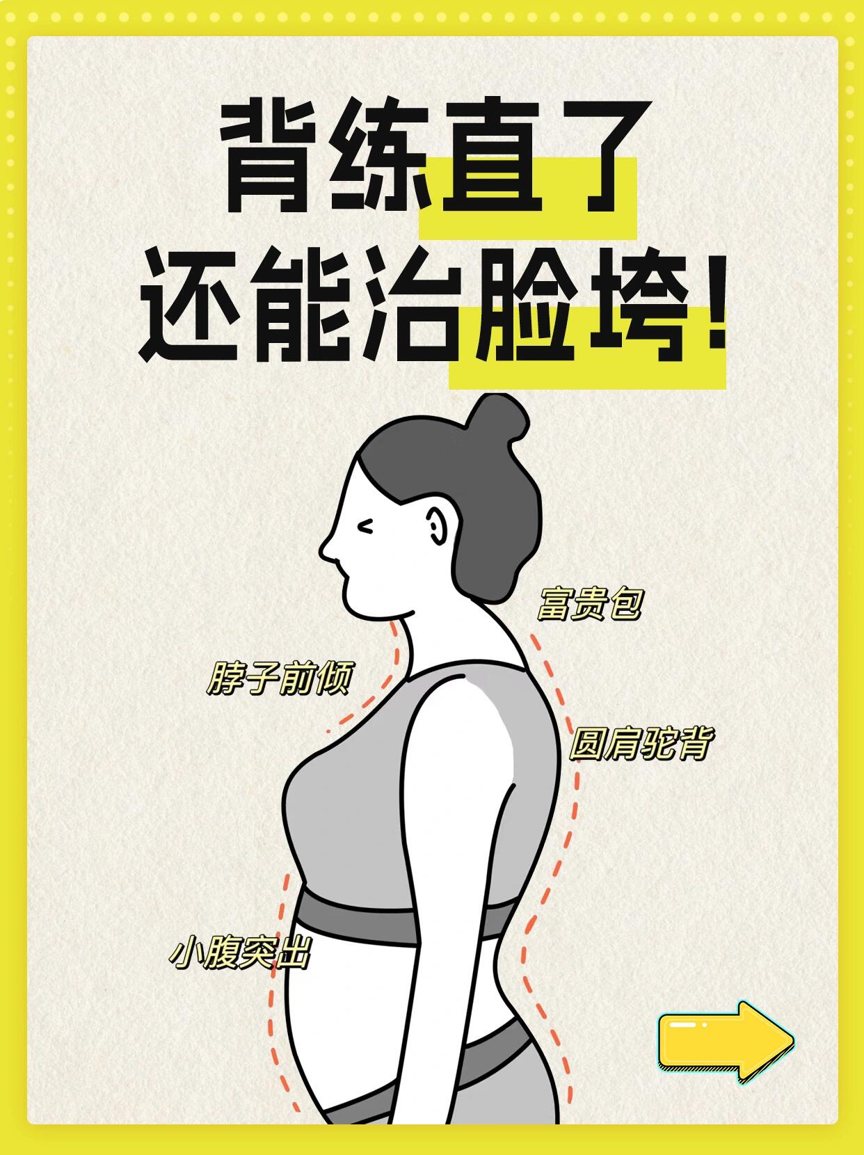 圆肩驼背,脖子前倾,富贵包的一定一定要练这几个动作!