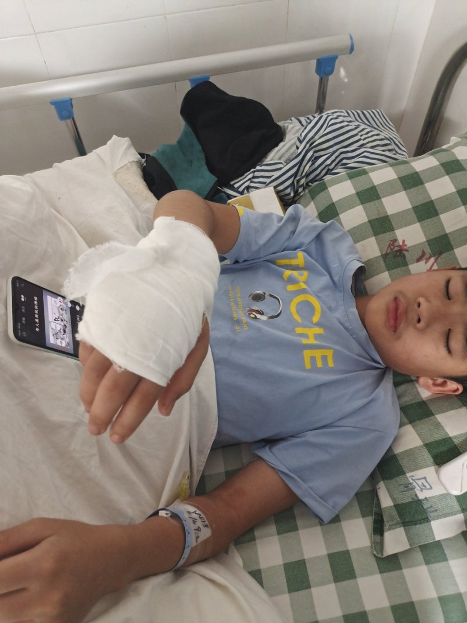 两兄弟手足情深,一个摔断两根手指一个摔骨折脚[捂脸][捂脸][捂脸]